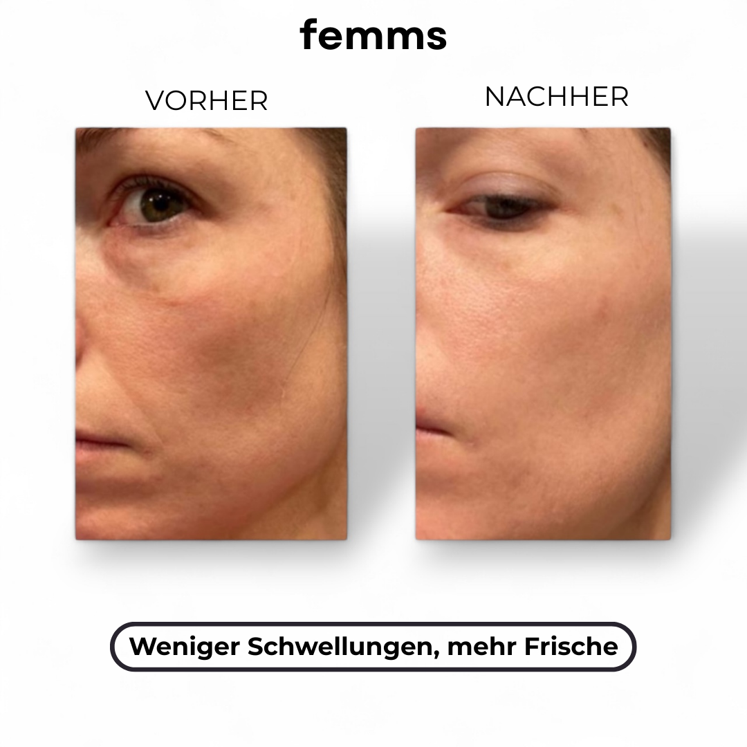 ProContour