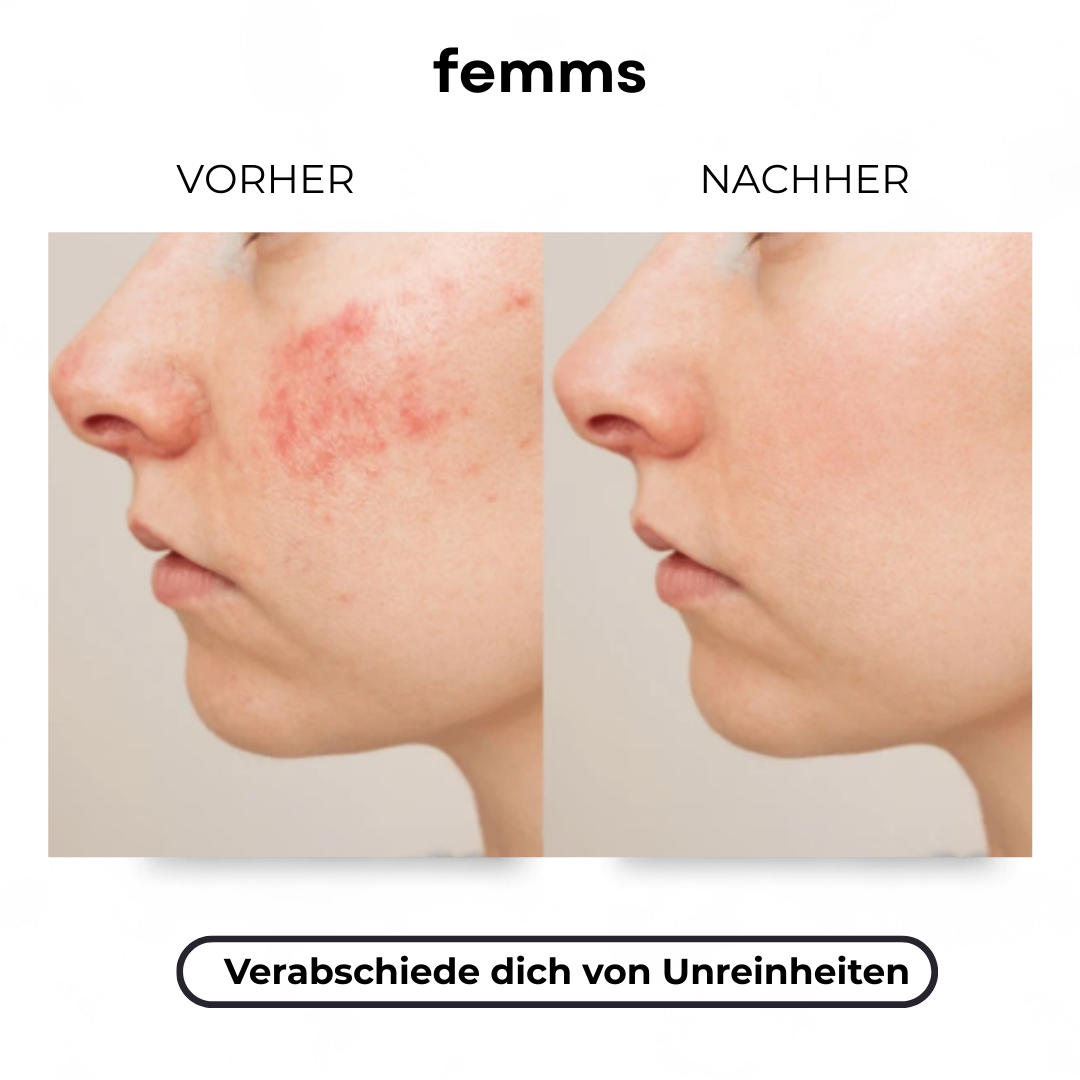 ProContour